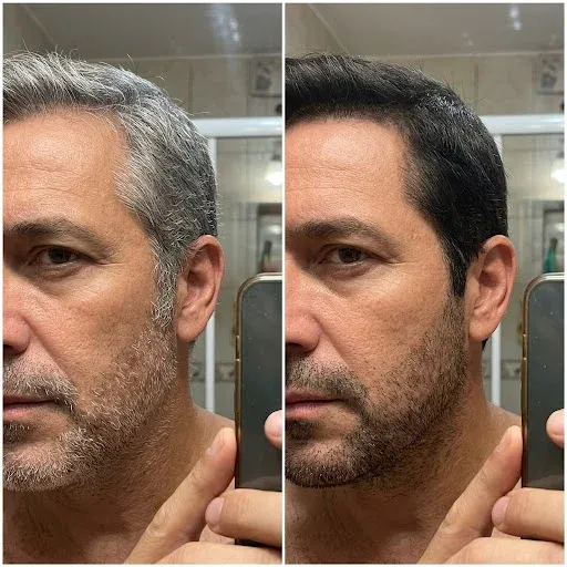 Antes y después de Rosana V.